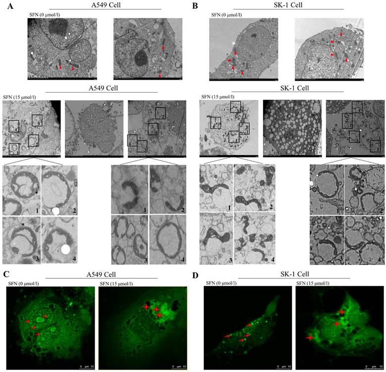 J Cancer Image