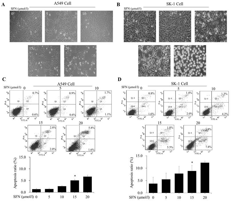 J Cancer Image