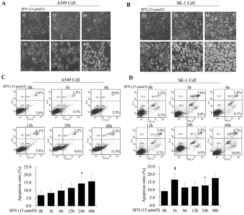 J Cancer Image