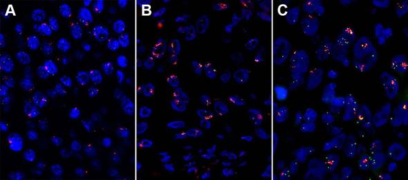 J Cancer Image