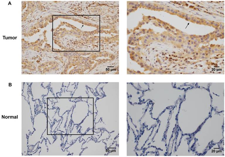 J Cancer Image