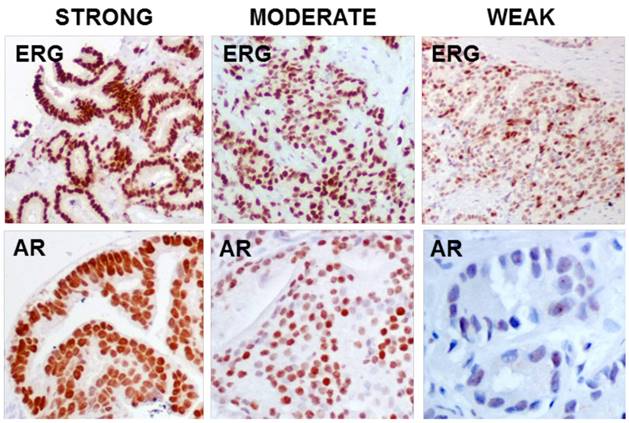 J Cancer Image