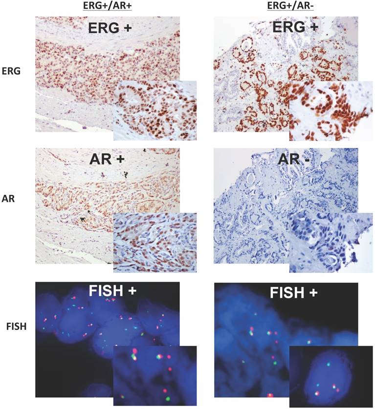 J Cancer Image