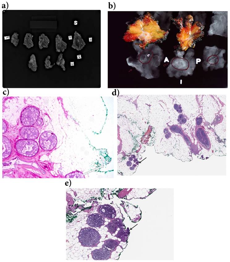 J Cancer Image