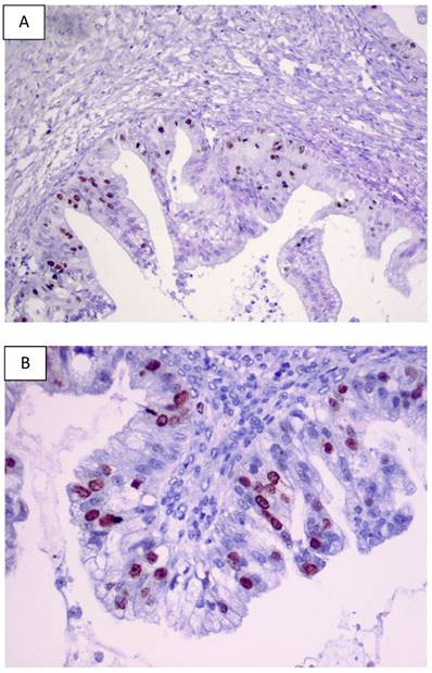 J Cancer Image