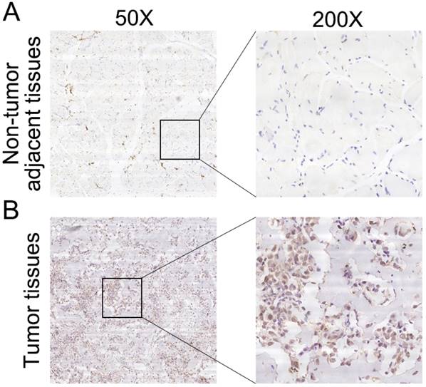 J Cancer Image