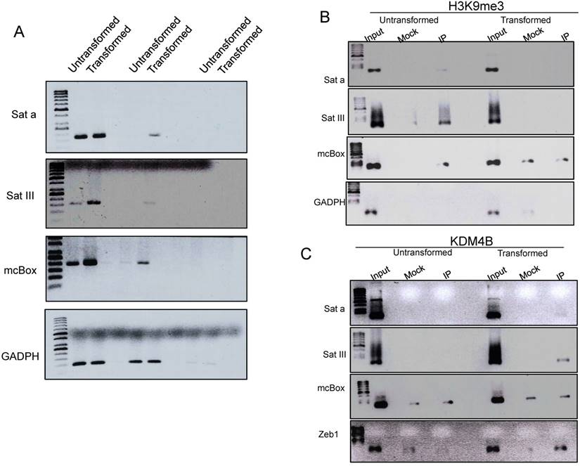 J Cancer Image