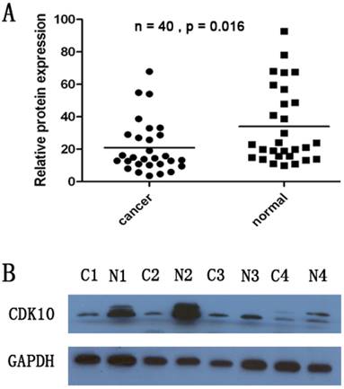 J Cancer Image