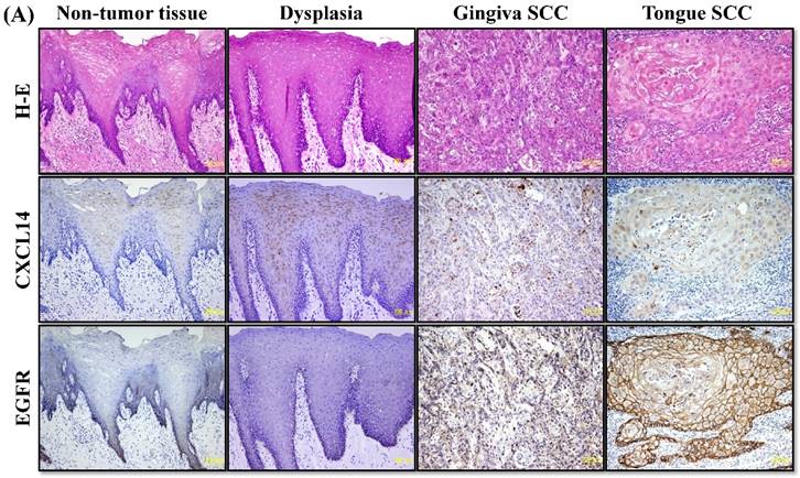 J Cancer Image