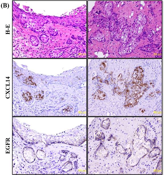 J Cancer Image