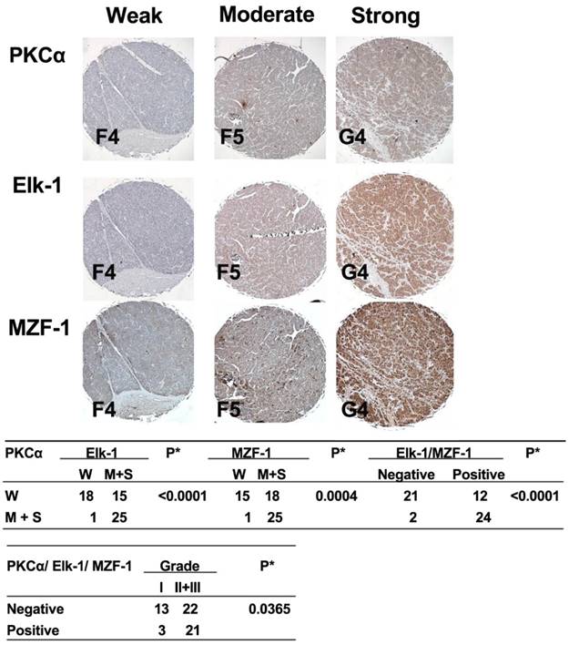 J Cancer Image