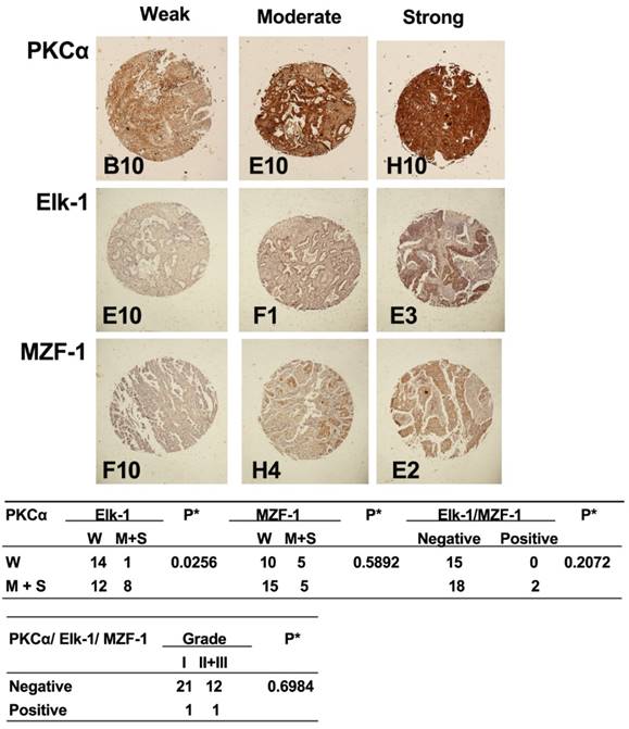 J Cancer Image