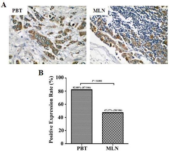 J Cancer Image