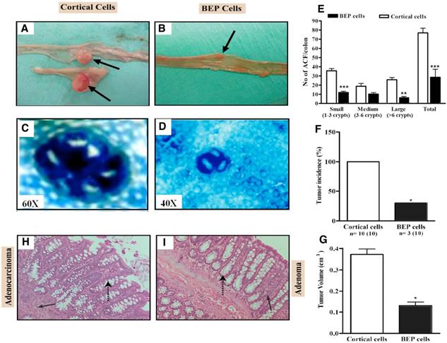 J Cancer Image