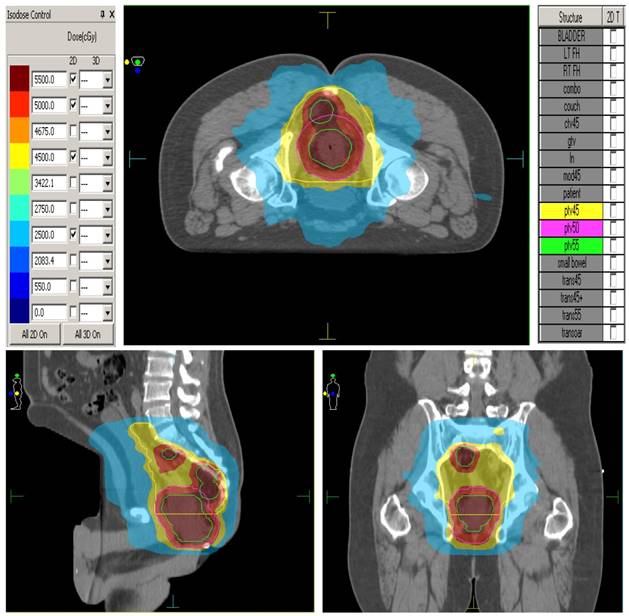 J Cancer Image