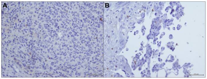 J Cancer Image