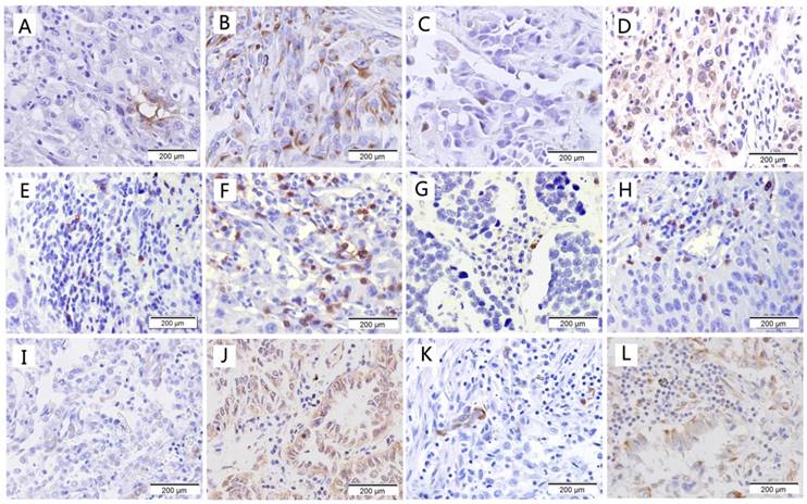 J Cancer Image