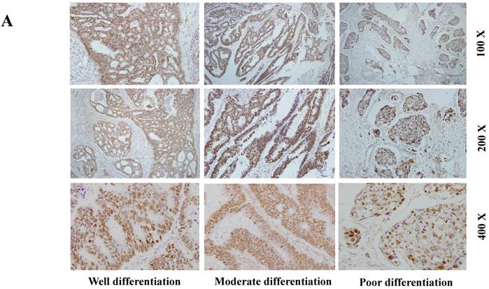 J Cancer Image