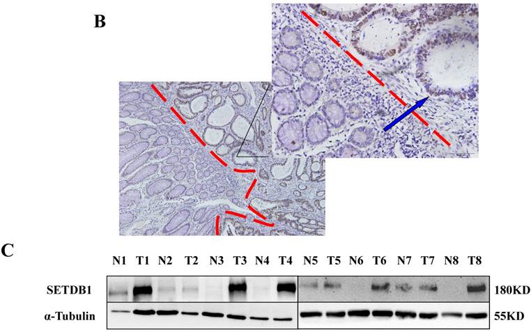 J Cancer Image