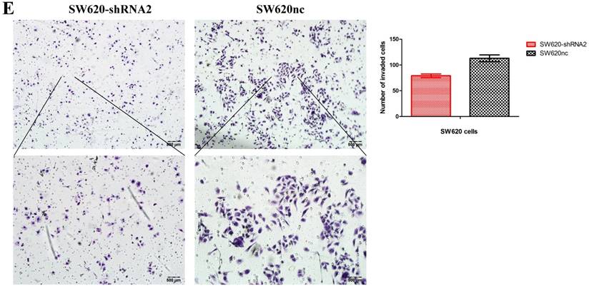 J Cancer Image