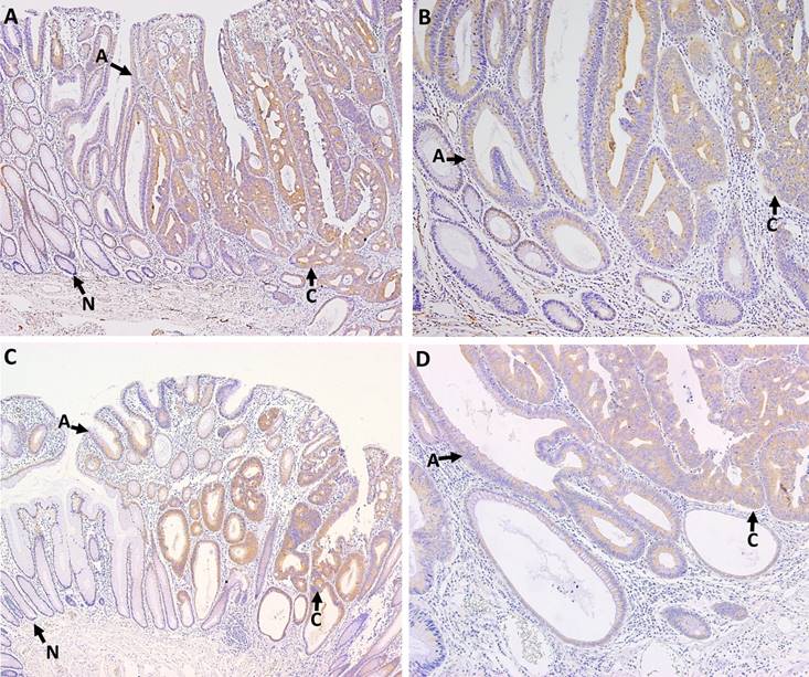 J Cancer Image