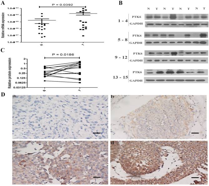 J Cancer Image