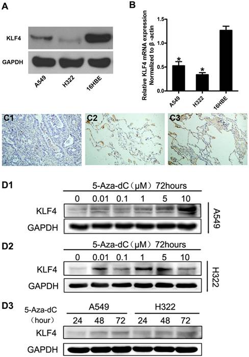 J Cancer Image