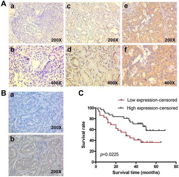 J Cancer Image