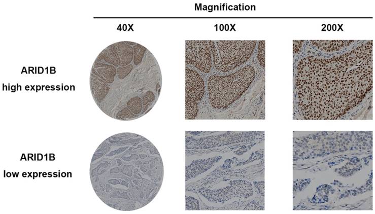 J Cancer Image