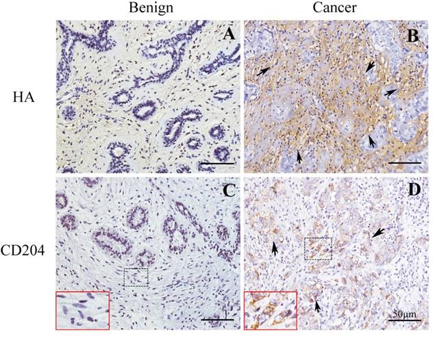 J Cancer Image