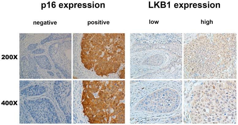 J Cancer Image