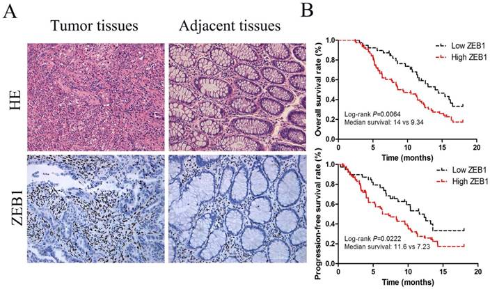 J Cancer Image