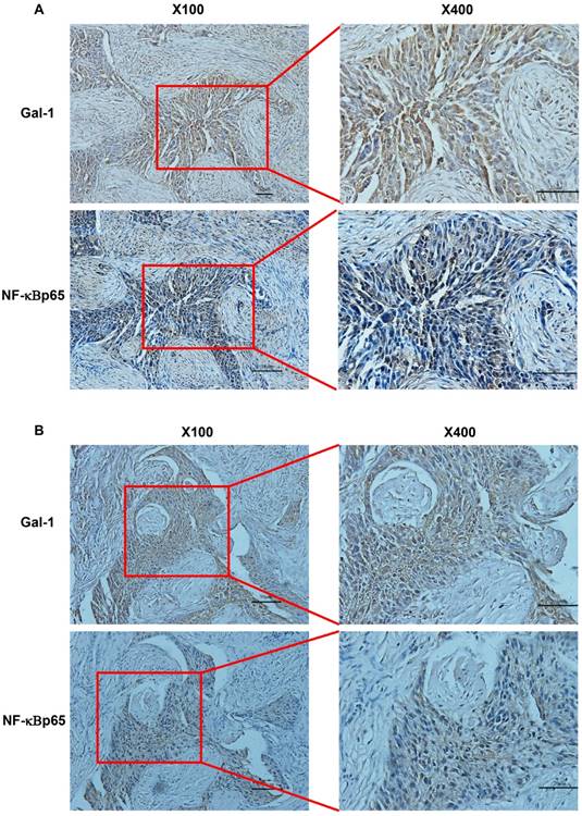 J Cancer Image