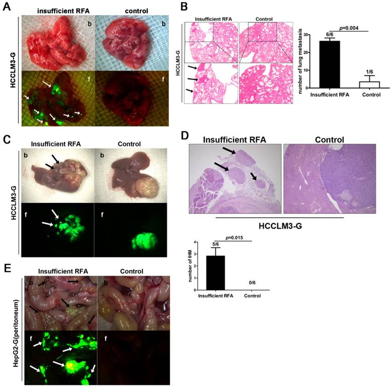 J Cancer Image