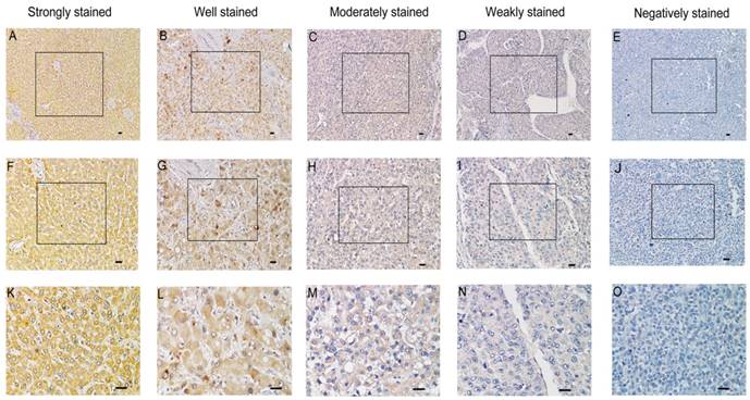 J Cancer Image