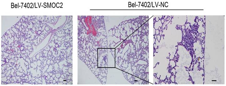 J Cancer Image