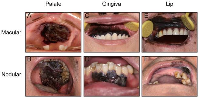 J Cancer Image