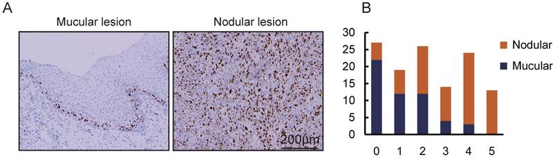 J Cancer Image