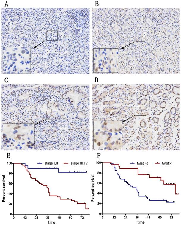 J Cancer Image