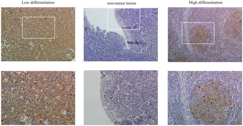 J Cancer Image