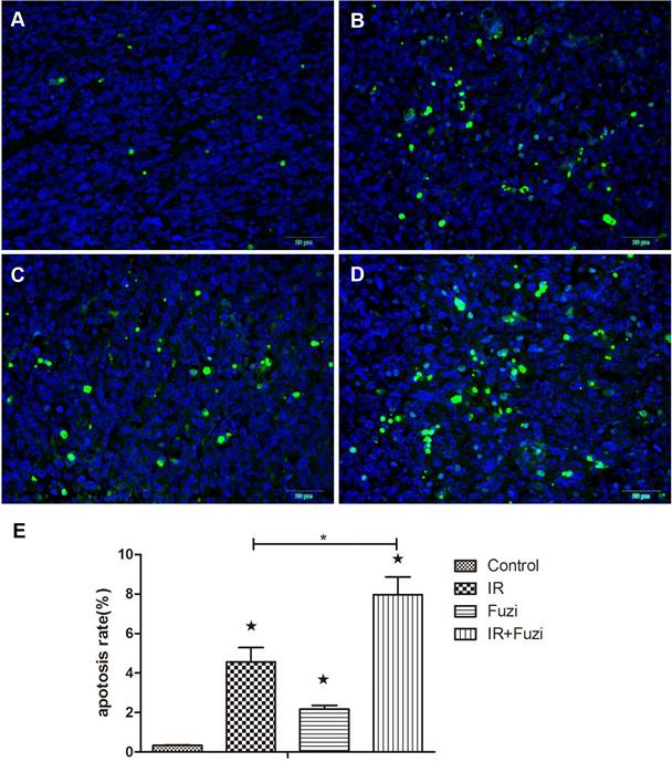 J Cancer Image