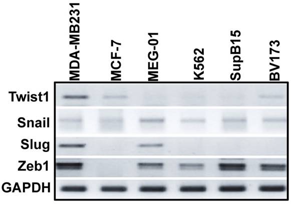 J Cancer Image