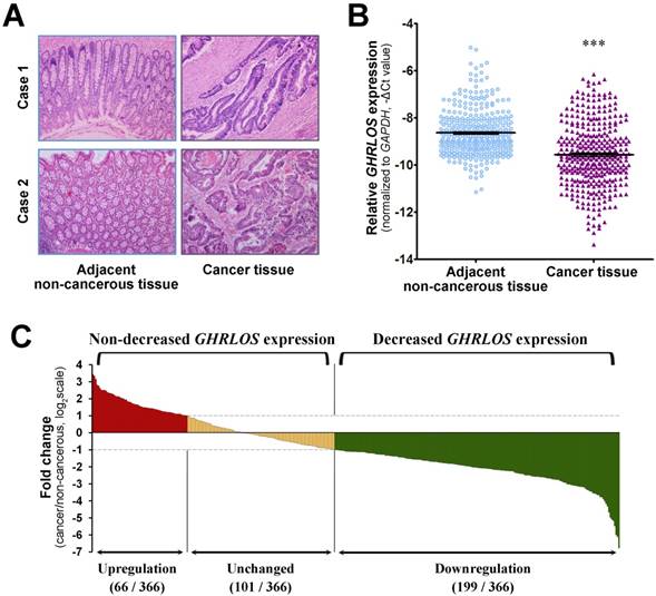 J Cancer Image