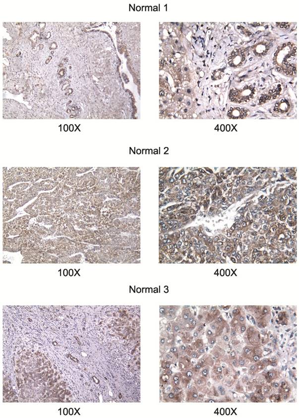 J Cancer Image