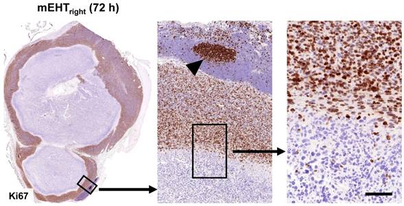 J Cancer Image