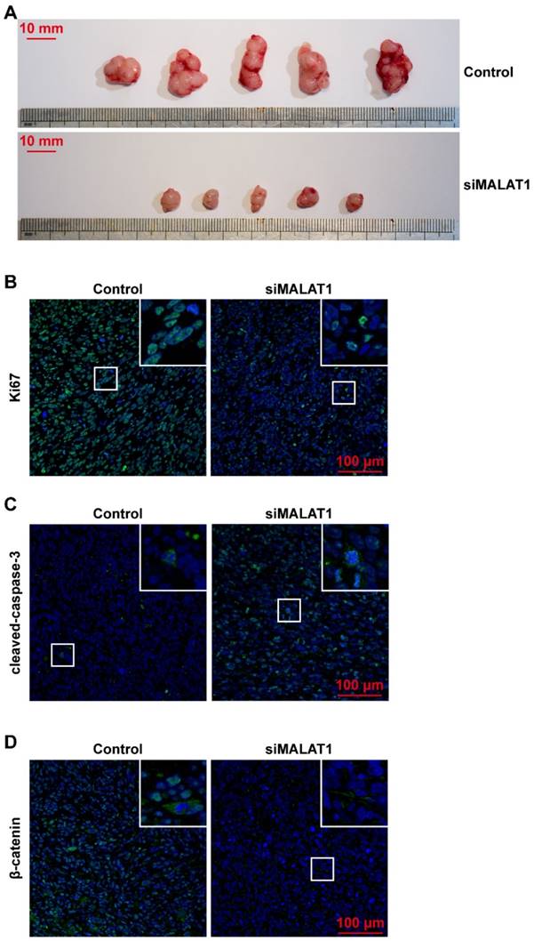 J Cancer Image