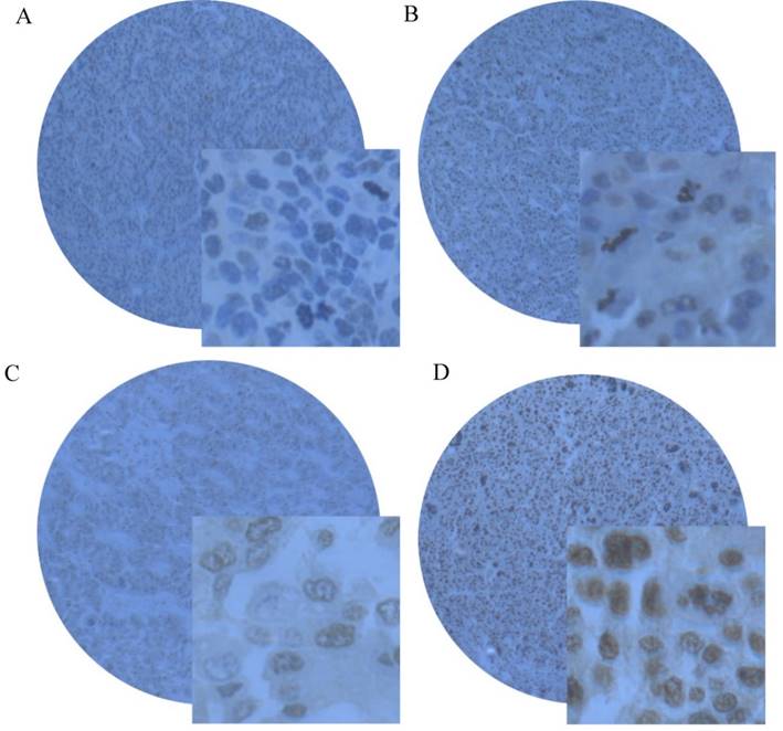 J Cancer Image