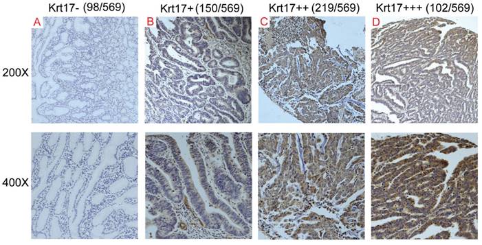 J Cancer Image