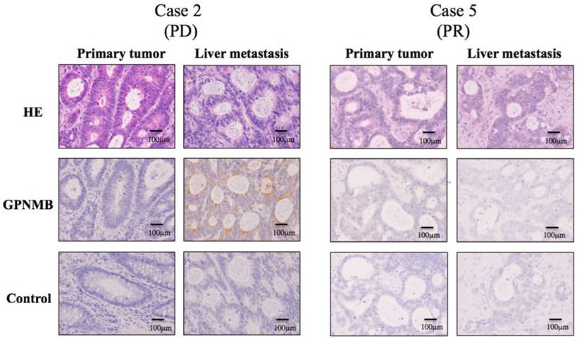 J Cancer Image