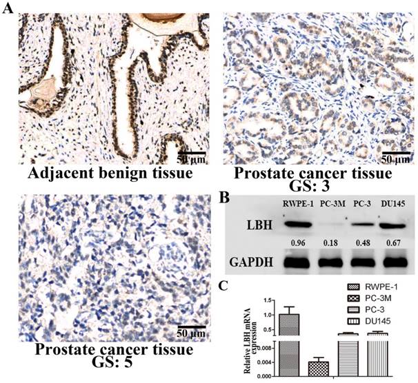 J Cancer Image